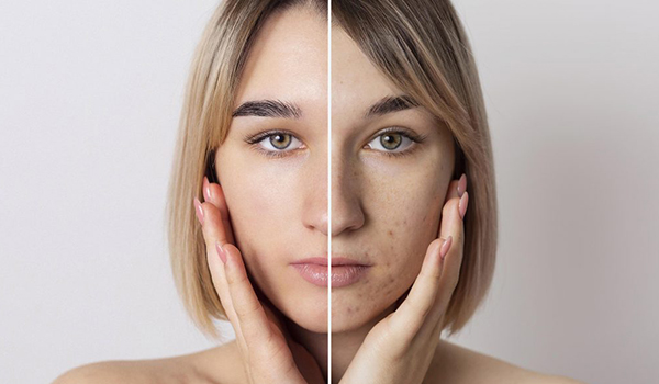 before-and-after-portrait-of-woman-retouched-1024x683